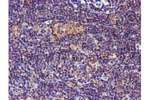 Image no. 2 for anti-Spermine Synthase, SMS (SMS) antibody (ABIN1501093)