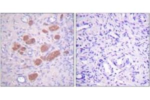 Immunohistochemistry analysis of paraffin-embedded human ovary, using p40 phox (Phospho-Thr154) Antibody.