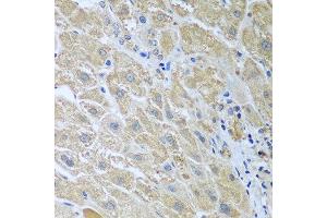Immunohistochemistry of paraffin-embedded human liver using WDR48 antibody at dilution of 1:100 (40x lens). (WDR48 anticorps)