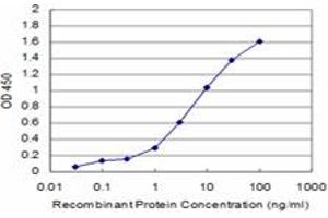 Detection limit for recombinant GST tagged BRD3 is approximately 0. (BRD3 anticorps  (AA 418-556))