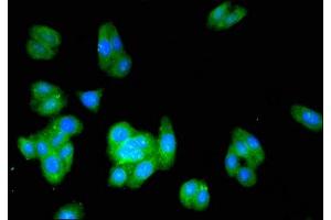 Immunofluorescent analysis of HepG2 cells using ABIN7142142 at dilution of 1:100 and Alexa Fluor 488-congugated AffiniPure Goat Anti-Rabbit IgG(H+L)