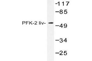 Western blot (WB) analysis of AP20411PU-N PFK-2 liv antibody in extracts from HUVEC cells. (PFKFB1 anticorps)