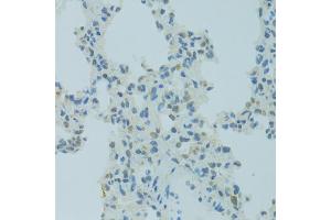 Immunohistochemistry of paraffin-embedded rat lung using MBD2 antibody.