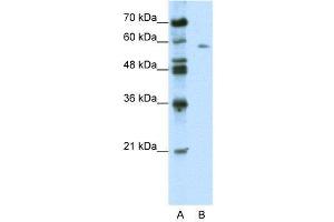 WB Suggested Anti-BTBD14A  Antibody Titration: 0. (BTBD14A anticorps  (C-Term))