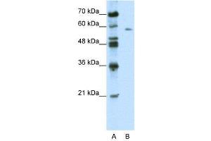 WB Suggested Anti-BTBD14A  Antibody Titration: 0.
