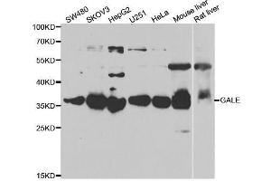 Western blot analysis of extracts of various cell lines, using GALE antibody. (GALE anticorps  (AA 129-348))