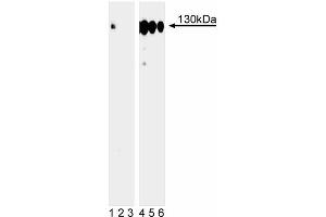 Western blot analysis of p130Cas (pY249) in human Burkitt’s lymphoma. (BCAR1 anticorps  (pTyr249))