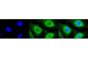 Immunocytochemistry/Immunofluorescence analysis using Rabbit Anti-GRP94 Polyclonal Antibody (ABIN1686652 and ABIN1686653).