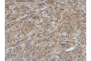 IHC-P Image Immunohistochemical analysis of paraffin-embedded U87 xenograft, using Ferredoxin Reductase, antibody at 1:500 dilution.