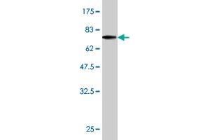 Western Blot detection against Immunogen (70.