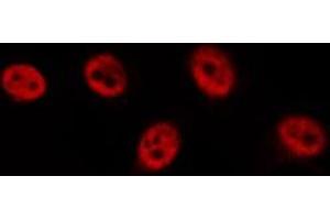 ABIN6277119 staining  HeLa cells by IF/ICC. (p63 anticorps)