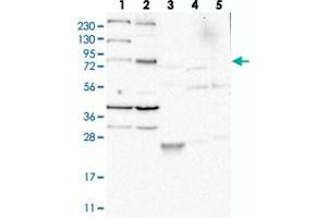 Western blot analysis of Lane 1: RT-4, Lane 2: U-251 MG, Lane 3: Human Plasma, Lane 4: Liver, Lane 5: Tonsil with LOC389813 polyclonal antibody  at 1:250-1:500 dilution. (AJM1/C9ORF172 anticorps)