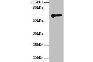 Western blot All lanes: TPTE antibody at 2 μg/mL + HepG2 whole cell lysate Secondary Goat polyclonal to rabbit IgG at 1/10000 dilution Predicted band size: 65, 63, 61, 50 kDa Observed band size: 65 kDa (TPTE anticorps  (AA 175-380))