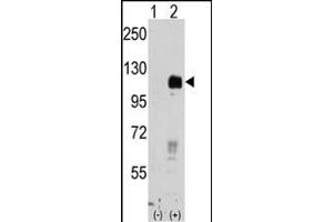 Western blot analysis of EphB4 (arrow) using rabbit polyclonal EphB4 Antibody (ABIN391924 and ABIN2841734). (EPH Receptor B4 anticorps)