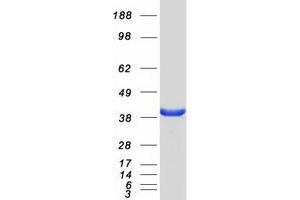 Validation with Western Blot