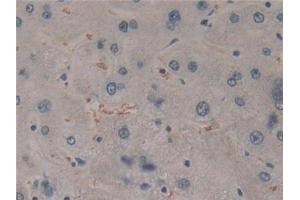Detection of CYLD in Human Liver Tissue using Polyclonal Antibody to Cylindromatosis (CYLD) (CYLD anticorps  (AA 170-338))