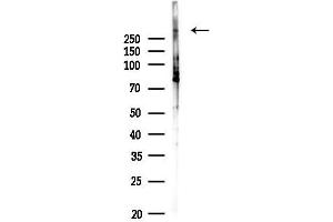 anti-Nuclear Receptor Co-Repressor 2 (NCOR2) (C-Term) antibody