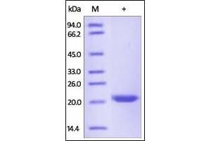 Human TIMP-2, His Tag on SDS-PAGE under reducing (R) condition. (TIMP2 Protein (AA 27-220) (His tag))
