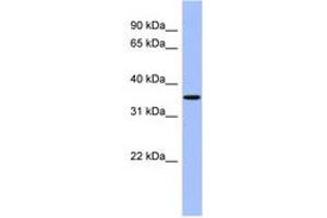 Image no. 1 for anti-Protein Phosphatase, Mg2+/Mn2+ Dependent, 1A (PPM1A) (AA 107-156) antibody (ABIN6744214)