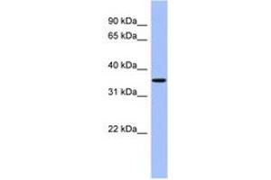 Image no. 1 for anti-Protein Phosphatase, Mg2+/Mn2+ Dependent, 1A (PPM1A) (AA 107-156) antibody (ABIN6744214) (PPM1A anticorps  (AA 107-156))