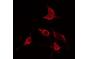 ABIN6274753 staining Hela cells by IF/ICC. (RPS23 anticorps  (N-Term))