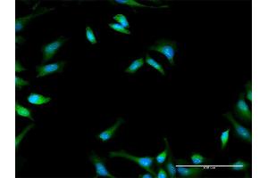 Immunofluorescence of purified MaxPab antibody to PFKFB1 on HeLa cell. (PFKFB1 anticorps  (AA 1-471))