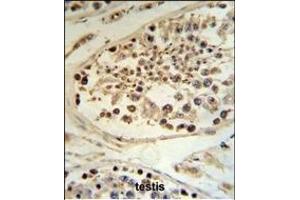 anti-DEK Oncogene (DEK) (AA 336-364), (C-Term) antibody