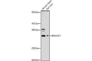 Western blot analysis of extracts of various cell lines, using DN antibody (ABIN3016214, ABIN3016215, ABIN3016216, ABIN1679557 and ABIN6219627) at 1:1000 dilution. (DNASE1 anticorps  (AA 22-282))