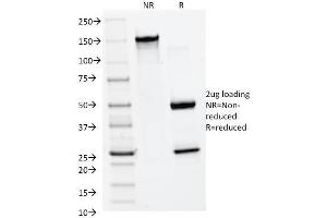 SDS-PAGE Analysis Purified MMP2 Monoclonal Antibody (MMP2/1501). (MMP2 anticorps  (AA 444-575))