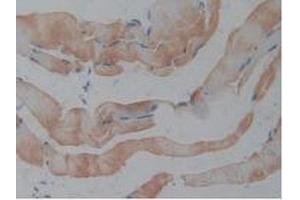 Figure. (REG3B anticorps  (AA 27-175))