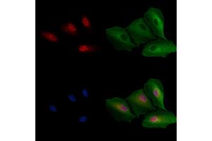 ABIN7094498 and ABIN7098547 staining  cells by IF/ICC.