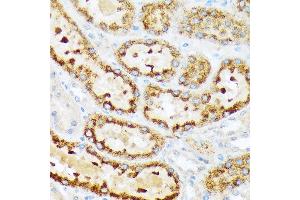 Immunohistochemistry of paraffin-embedded rat kidney using ENTPD5 Rabbit mAb (ABIN7266895) at dilution of 1:100 (40x lens).