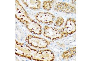 Immunohistochemistry of paraffin-embedded rat kidney using ENTPD5 Rabbit mAb (ABIN7266895) at dilution of 1:100 (40x lens). (ENTPD5 anticorps)