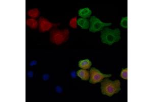 ABIN6257902 and ABIN6274337 staining Hela cells by IF/ICC. (IB2 anticorps  (Internal Region))