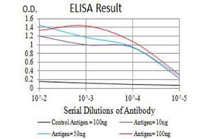 Black line: Control Antigen (100 ng),Purple line: Antigen (10 ng), Blue line: Antigen (50 ng), Red line:Antigen (100 ng)