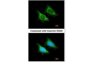 ICC/IF Image Immunofluorescence analysis of methanol-fixed HeLa, using MRPS5, antibody at 1:200 dilution. (MRPS5 anticorps)