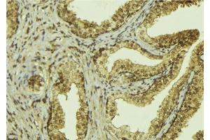 ABIN6276526 at 1/100 staining Mouse colon tissue by IHC-P. (MSH2 anticorps  (C-Term))