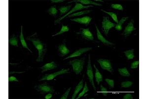 Immunofluorescence of purified MaxPab antibody to RELB on HeLa cell. (RELB anticorps  (AA 1-579))