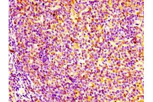 anti-GM2 Ganglioside Activator (GM2A) (AA 32-193) antibody