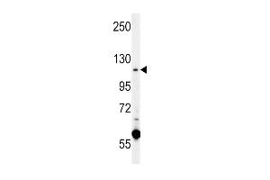 CACNA2D4 Antibody (N-term) (ABIN651895 and ABIN2840441) western blot analysis in K562 cell line lysates (15 μg/lane).