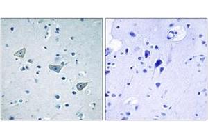Immunohistochemistry analysis of paraffin-embedded human brain tissue, using GPR158 Antibody. (GPR158 anticorps  (AA 1-50))