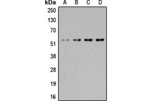 Western blot analysis of SGK1/2 expression in Jurkat (A), HeLa (B), NIH3T3 (C), PC12 (D) whole cell lysates.