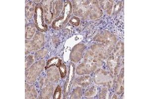 Immunohistochemical staining of human kidney with COX20 polyclonal antibody  shows strong cytoplasmic positivity in subset of renal tubules at 1:50-1:200 dilution. (FAM36A anticorps)