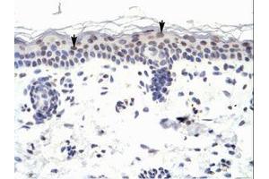 Image no. 1 for anti-Zinc Finger Protein 223 (ZNF223) (AA 95-144) antibody (ABIN6735983)