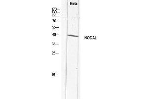 Western Blot (WB) analysis of HeLa lysis using NODAL antibody. (Nodal anticorps)