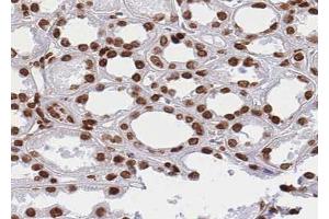 ABIN6268824 at 1/100 staining human kidney tissue sections by IHC-P. (HNRNPM anticorps  (N-Term))
