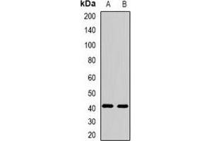 Western blot analysis of FBXO32 expression in mouse heart (A), mouse skeletal muscle (B) whole cell lysates. (FBXO32 anticorps)
