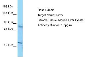 Host: Rabbit Target Name: Tshz2 Sample Type: Mouse Liver lysates Antibody Dilution: 1. (TSHZ2 anticorps  (Middle Region))