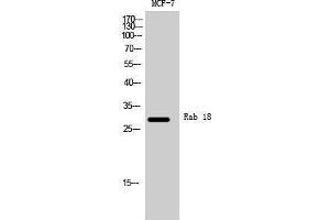 Western Blotting (WB) image for anti-RAB18, Member RAS Oncogene Family (RAB18) (Internal Region) antibody (ABIN3186613) (RAB18 anticorps  (Internal Region))