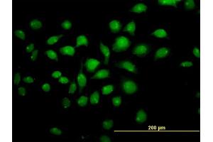 Immunofluorescence of monoclonal antibody to TFAP4 on HeLa cell. (TFAP4 anticorps  (AA 93-192))